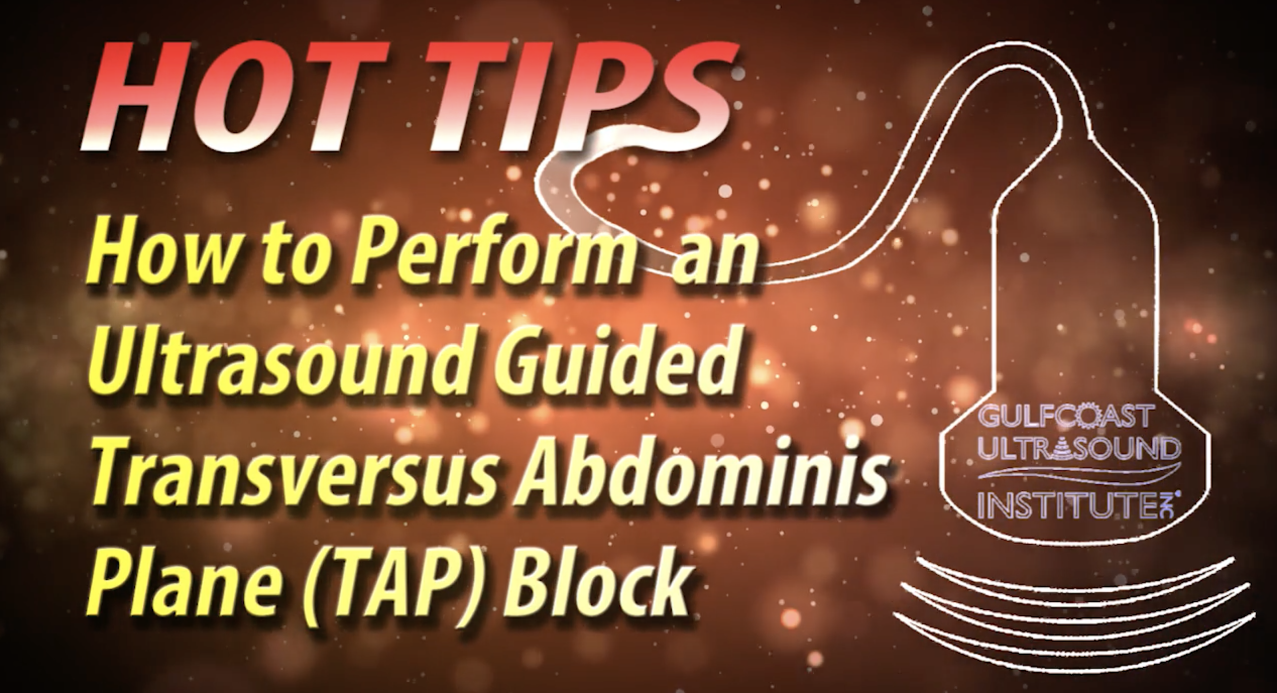 How to Perform an Ultrasound Guided Transversus Abdominis Plane (TAP) Block